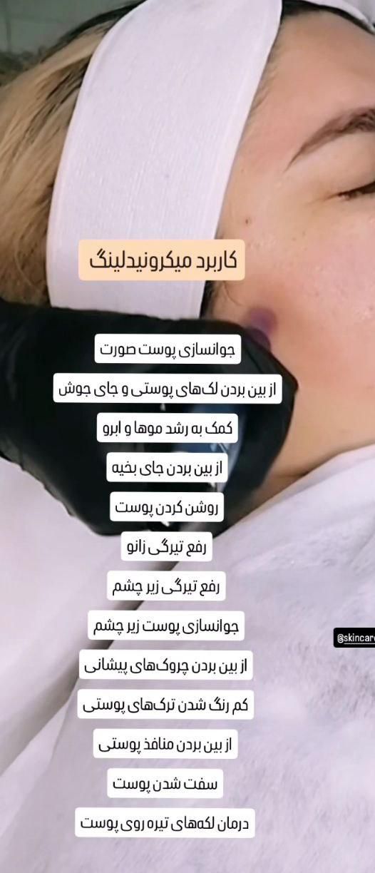آموزش تخصصی پاکسازی و فیشال پوست با دستگاه|خدمات آموزشی|شاهین‌شهر, عطار|دیوار