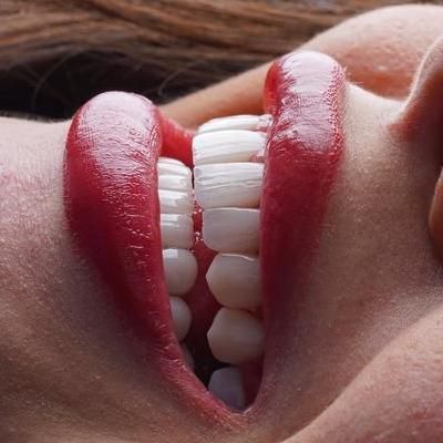 کامپوزیت دندان،لمینیت،روکش،عصب کشی|خدمات آرایشگری و زیبایی|تهران, سعادت‌آباد|دیوار