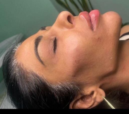 کلینیک تزریق ژل بوتاکس آنزیم فیلر لب لیزر هایفو|خدمات آرایشگری و زیبایی|کرج, گوهردشت|دیوار
