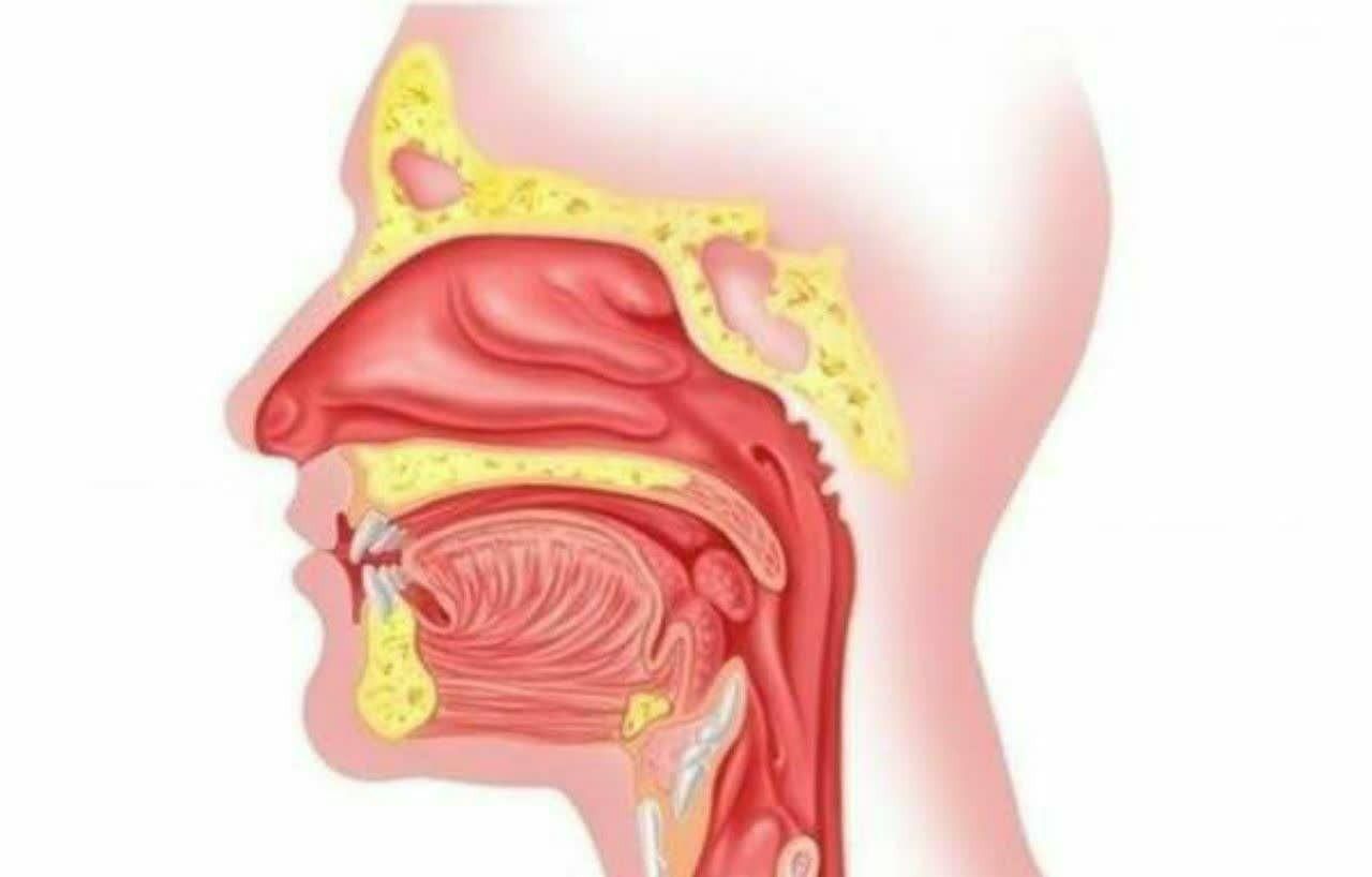 خلط پشت حلق|خدمات آموزشی|زنجان, |دیوار