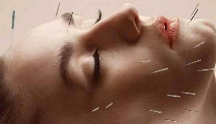 برگزاری همایش طب سوزنی صفر تا صد|گردهمایی و همایش|تهران, خاوران|دیوار