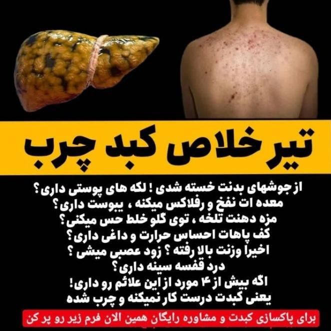 دمنوش معجزه آسای کبد چرب|خوردنی و آشامیدنی|کرمانشاه, |دیوار