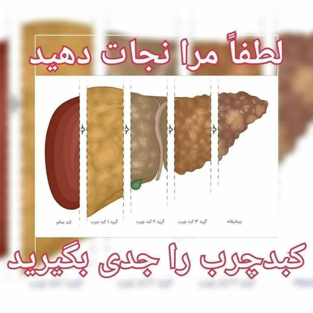 سم زدایی کبد چرب|فعالیت داوطلبانه|تهران, حشمتیه|دیوار