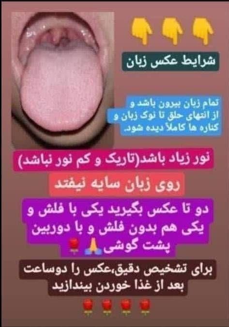 دمنوش کبد چرب|خوردنی و آشامیدنی|تهران, الهیه|دیوار