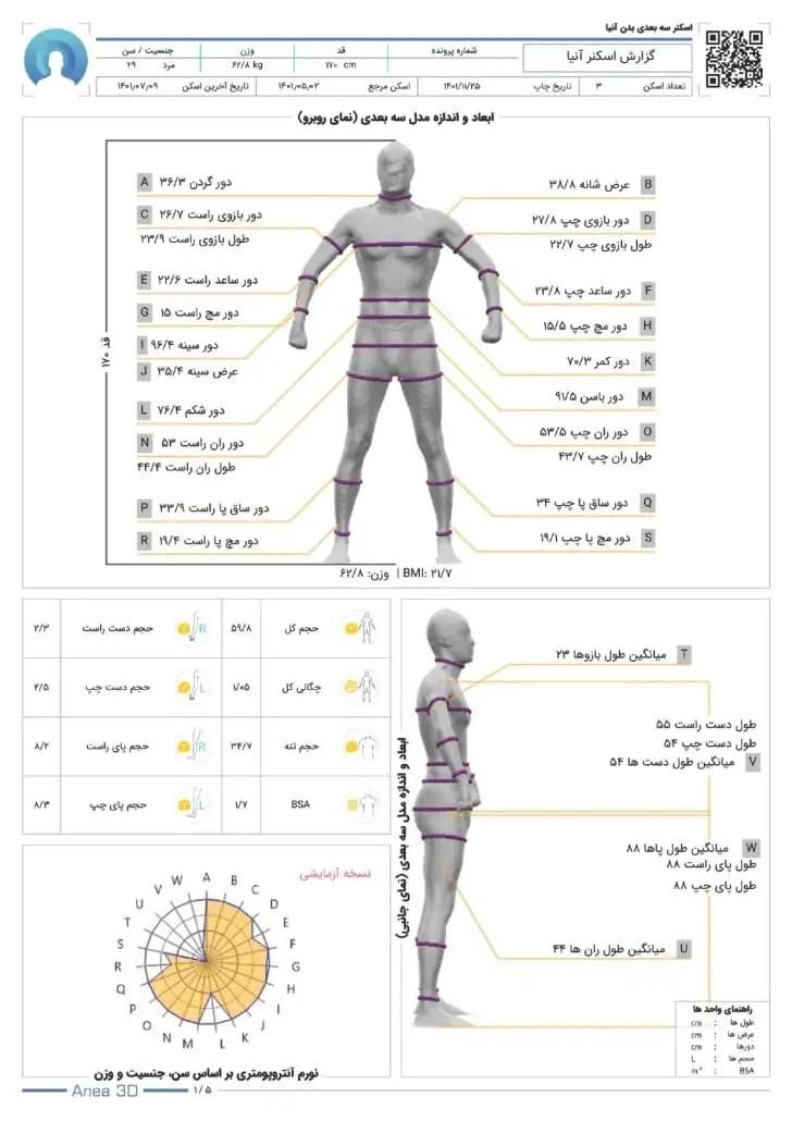 اسکنر سه بعدی آنالیز|تجهیزات ورزشی|تهران, مجیدیه|دیوار