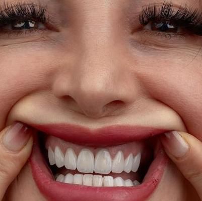 کامپوزیت دندان،لمینیت،روکش،عصب کشی|خدمات آرایشگری و زیبایی|تهران, شهرک غرب|دیوار