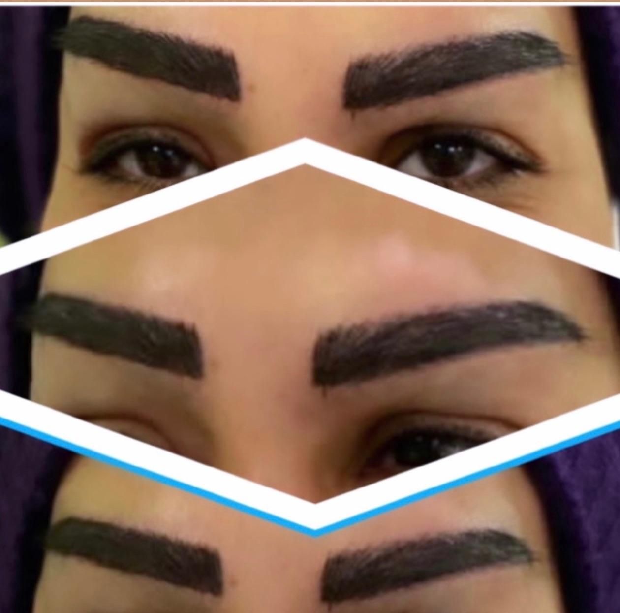 کاشت مو با ضمانت فقط ۸ میلیون|خدمات آرایشگری و زیبایی|تهران, زعفرانیه|دیوار