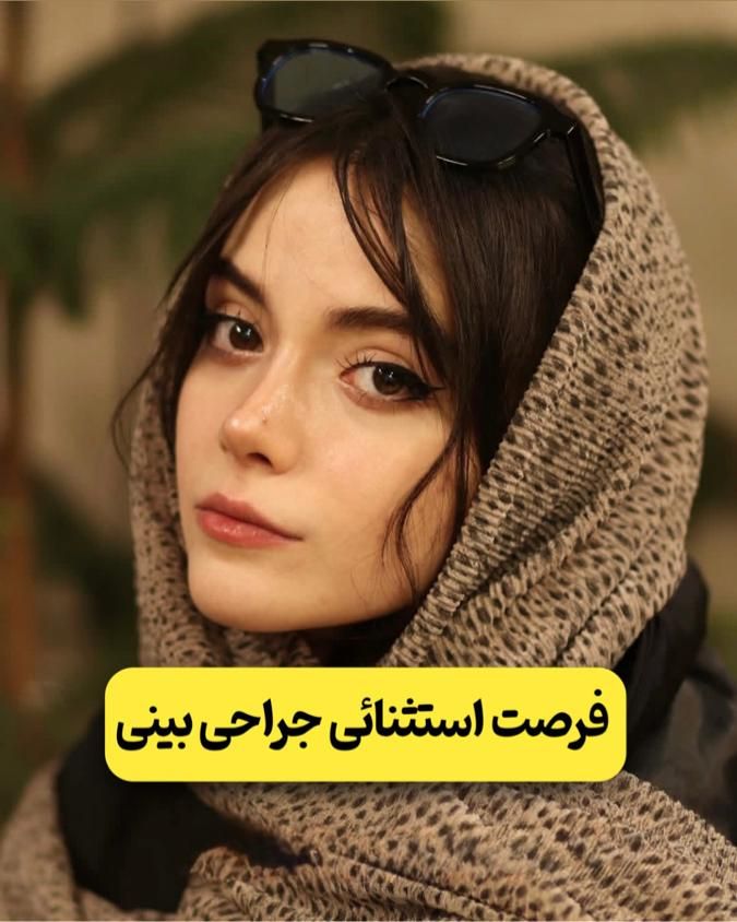 عمل جراحی بینی فقط۲۳|خدمات آرایشگری و زیبایی|تهران, قبا|دیوار