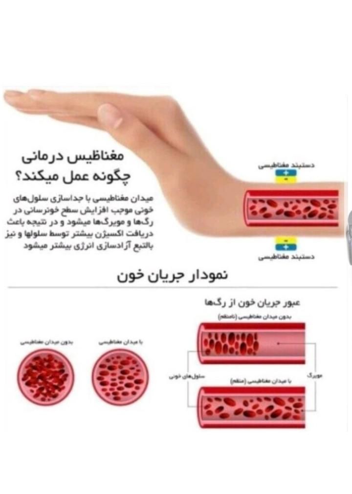 دستبند مغناطیسی درمانی اصل RainSo|جواهرات|تبریز, |دیوار