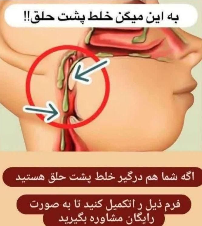 خلط گلو|خدمات آرایشگری و زیبایی|قم, جمهوری|دیوار