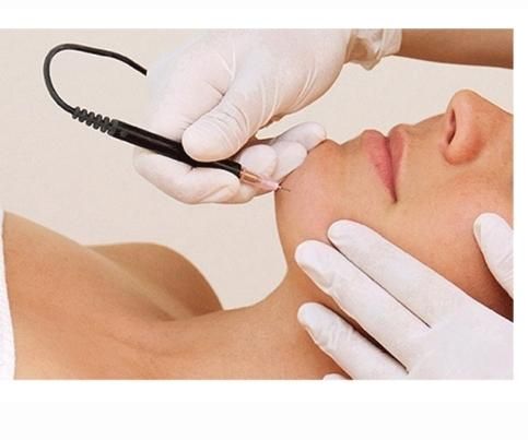 آموزش تخصصی الکترولیز موهای زائد|خدمات آموزشی|خمینی‌شهر, |دیوار