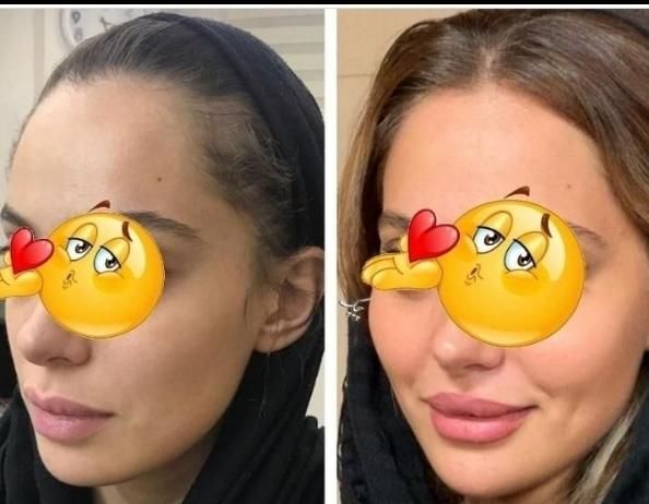 چاقی صورت تضمینی بادستگاه تخصصی و پیشرفته فقط خانم|خدمات آرایشگری و زیبایی|اصفهان, خانه اصفهان|دیوار