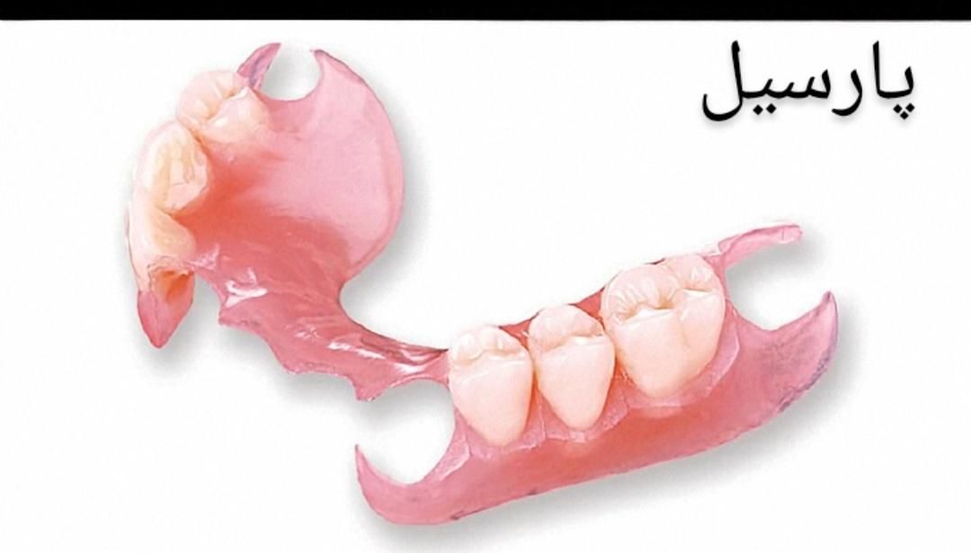 ساخت دندان مصنوعی هر فک فقط دو میلیون|خدمات آرایشگری و زیبایی|تهران, شمشیری|دیوار