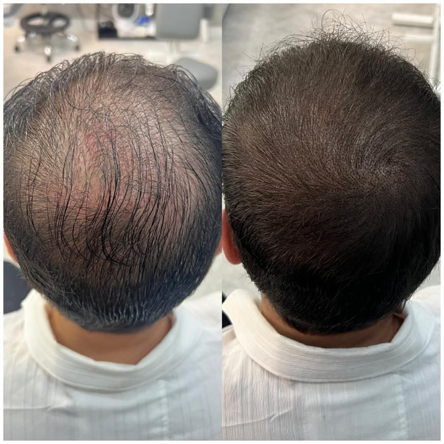 موهاتو پرپشت کن در سه ساعت|خدمات آرایشگری و زیبایی|تهران, صادقیه|دیوار