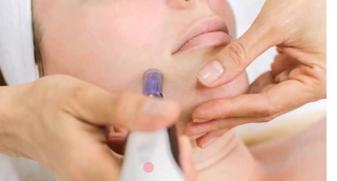 جوانساز روشنی پوست و زیر چشم و تقویت رویش موفقط490|خدمات آرایشگری و زیبایی|تهران, دروازه شمیران|دیوار