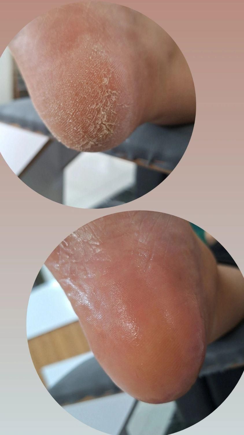 خدمات پدیکور و کفسابی پا|خدمات آرایشگری و زیبایی|محمدیه-قزوین, |دیوار