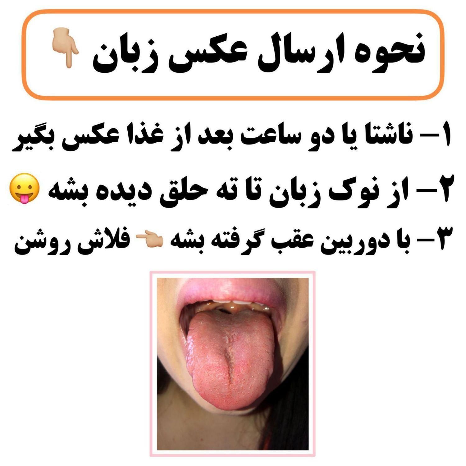 تشخیص بیماریهاازروی زبان ودرمان آنهاتوسط ما|فعالیت داوطلبانه|تهران, ستارخان|دیوار