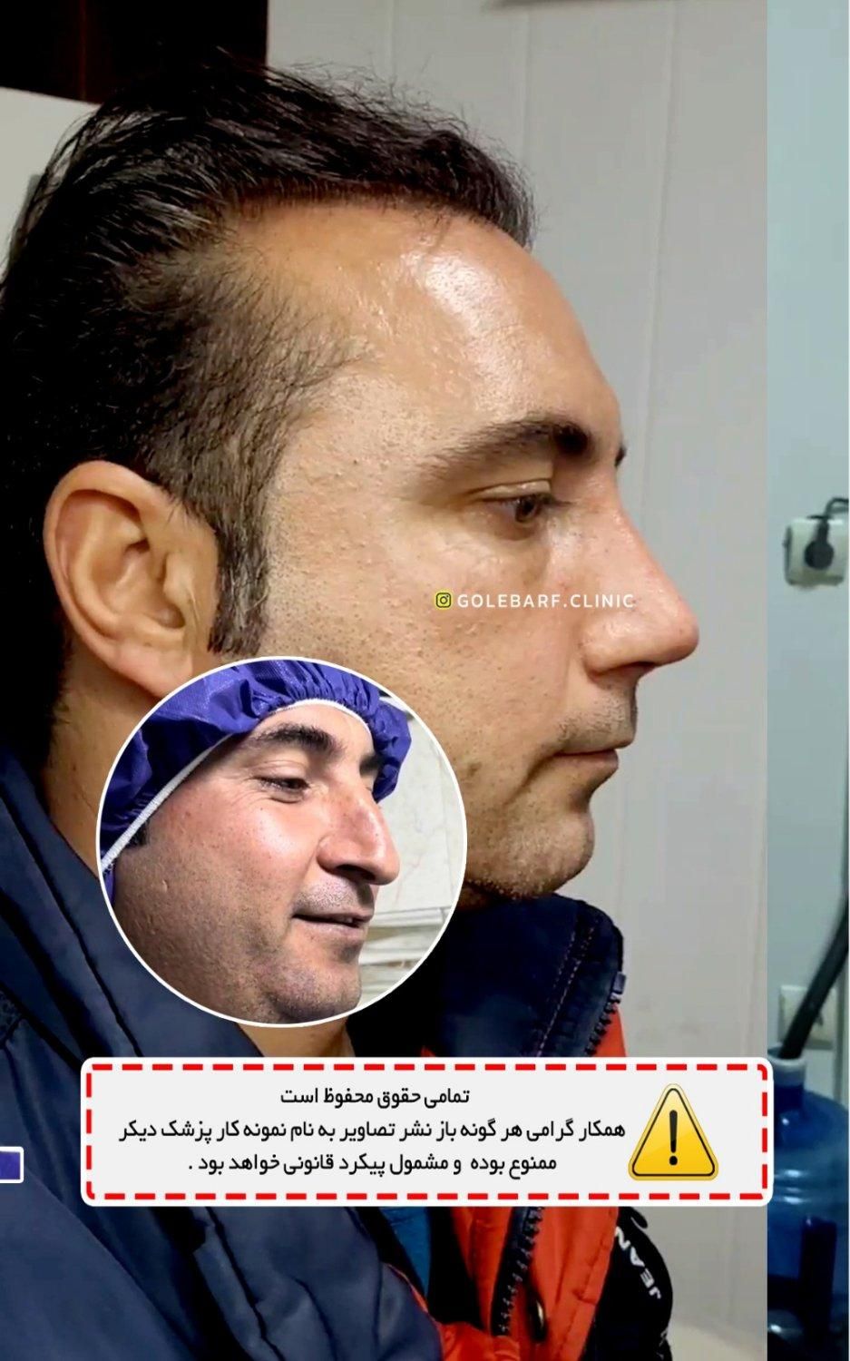 جشنواره جراحی و عمل بینی/لیفت/پلک|خدمات آرایشگری و زیبایی|کرج, درختی|دیوار