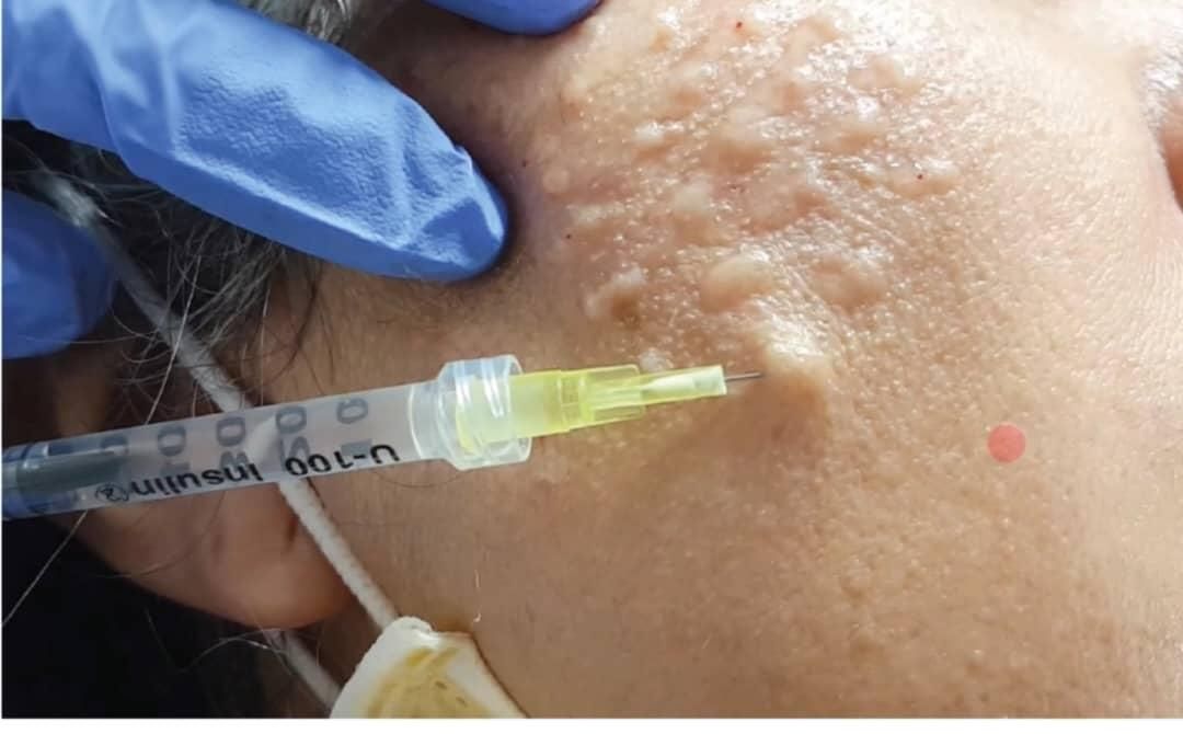 جوانساز روشنی پوست و زیر چشم و تقویت رویش موفقط490|خدمات آرایشگری و زیبایی|تهران, دروازه شمیران|دیوار