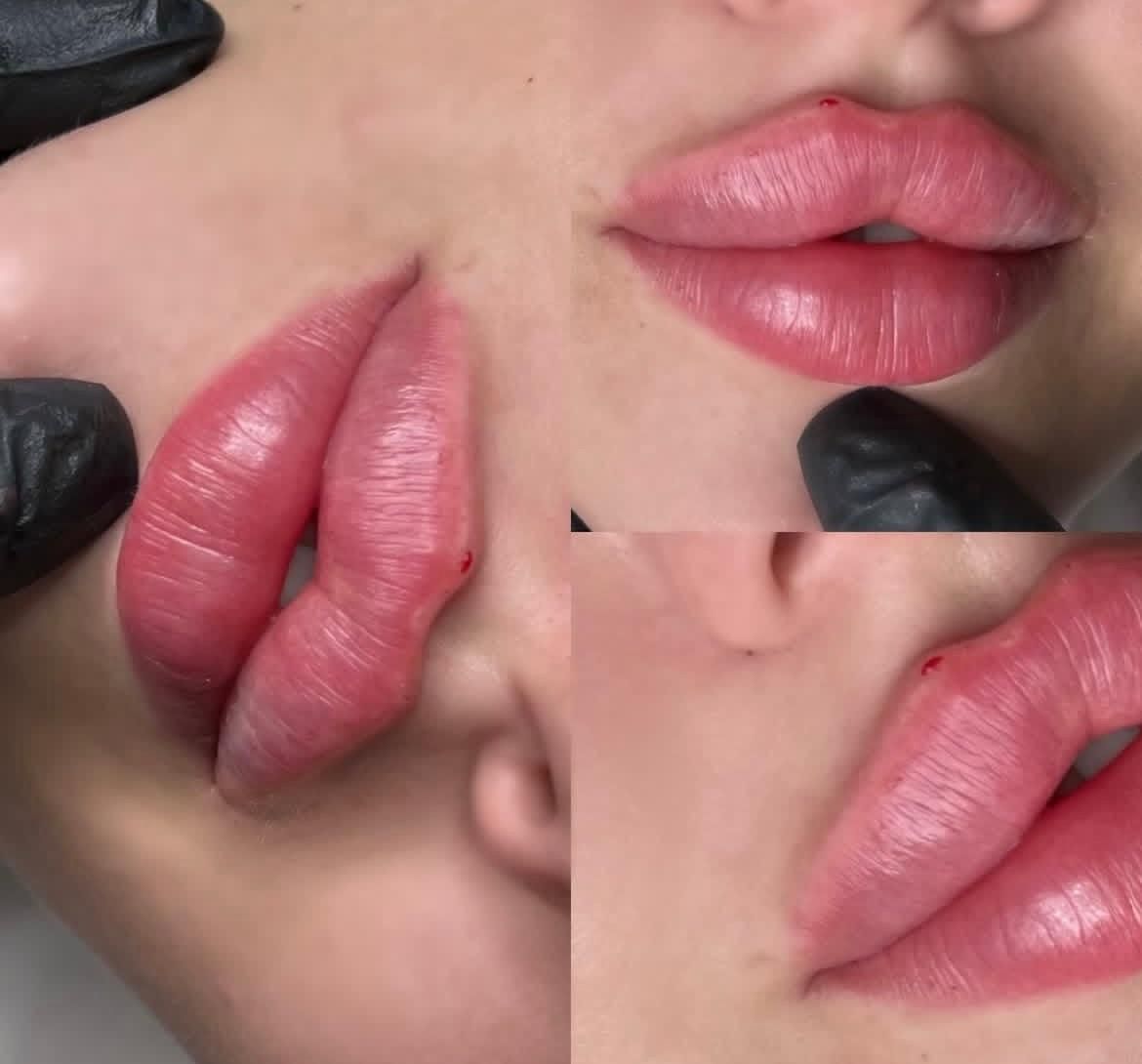 ژل لب فیلر لبروسی بوتاکس مزو جوانساز ژل گونه زاویه|خدمات آرایشگری و زیبایی|کرج, گوهردشت|دیوار