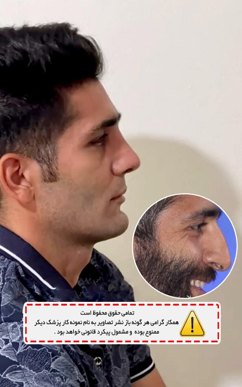 جشنواره جراحی و عمل بینی/لیفت/پلک|خدمات آرایشگری و زیبایی|کرج, درختی|دیوار