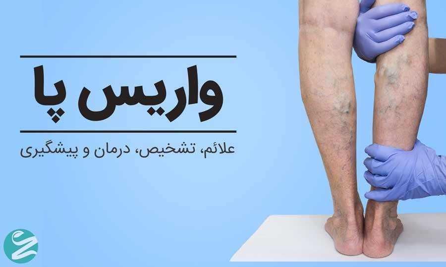 فروش پک درمان واریس|آرایشی، بهداشتی، درمانی|تهران, آذری|دیوار