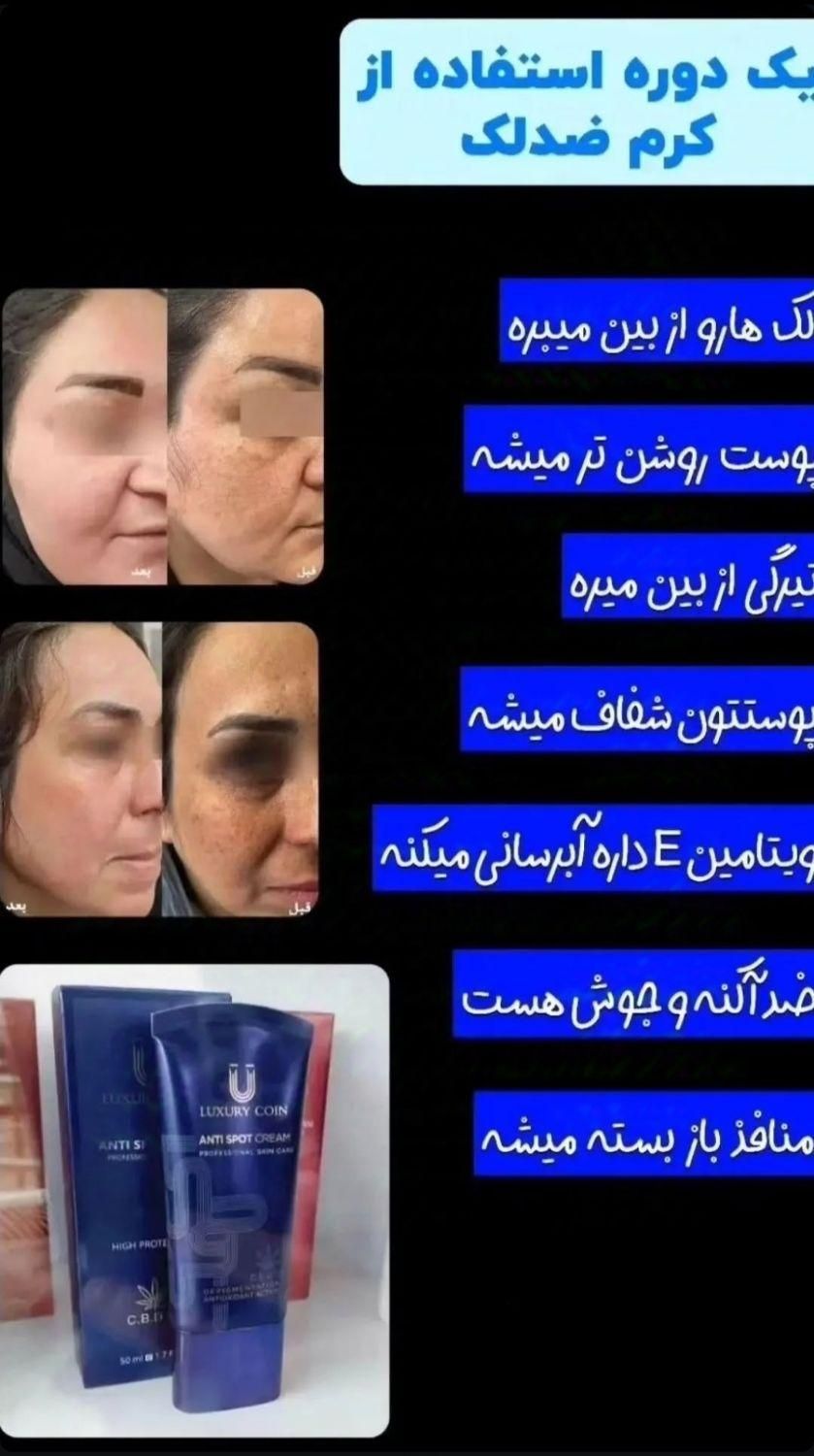 مشاور پوست و مو روتین پوستی کرم های ضدجوش لک چروک|آرایشی، بهداشتی، درمانی|تهران, باغ فیض|دیوار