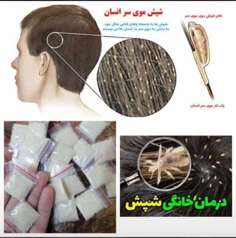 پودر شپش|آرایشی، بهداشتی، درمانی|تهران, یاخچی‌آباد|دیوار
