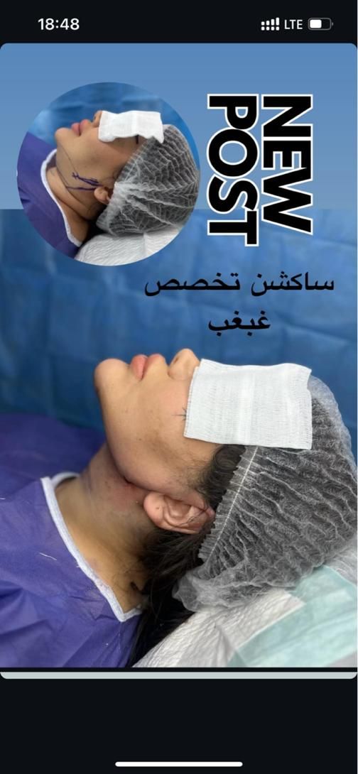 ساکشن غبغب نقد واقساط بوکال فت بلفارو کاشت ابرو|خدمات آرایشگری و زیبایی|تهران, پونک|دیوار