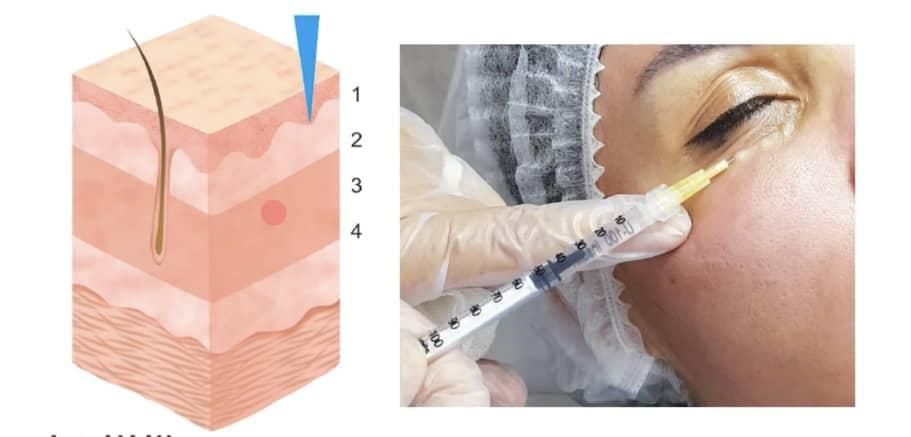 جوانساز روشنی پوست و زیر چشم و تقویت رویش موفقط490|خدمات آرایشگری و زیبایی|تهران, دروازه شمیران|دیوار