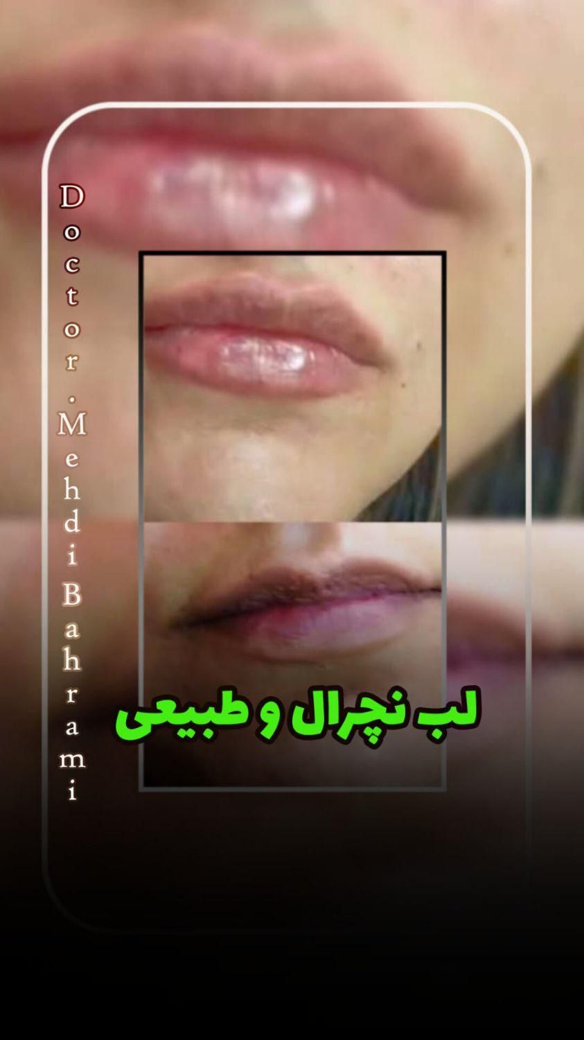 لیزرموی زایدتضمینی ژل وبوتاکس کلینیک دکتر بهرامی|خدمات آرایشگری و زیبایی|تهران, افسریه|دیوار