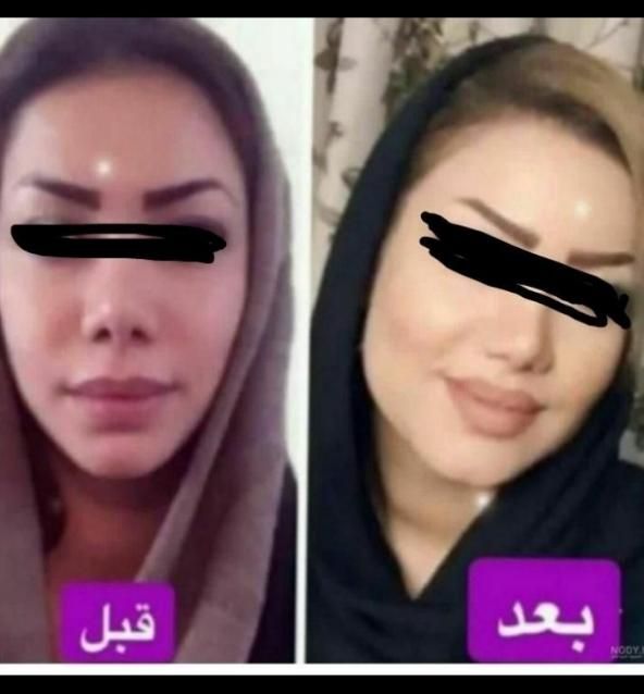 چاقی صورت تضمینی بادستگاه تخصصی و پیشرفته فقط خانم|خدمات آرایشگری و زیبایی|اصفهان, خانه اصفهان|دیوار