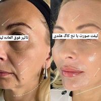جشنواره مرکز تزریق چربی صورت ،ژل ،بوتاکس.prp|خدمات آرایشگری و زیبایی|کرج, اصفهانی‌ها|دیوار
