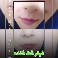 لیزرموی زایدتضمینی ژل وبوتاکس کلینیک دکتر بهرامی|خدمات آرایشگری و زیبایی|تهران, افسریه|دیوار