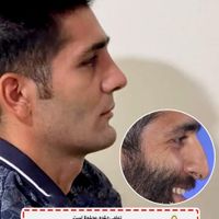 جشنواره جراحی و عمل بینی/لیفت/پلک|خدمات آرایشگری و زیبایی|کرج, درختی|دیوار