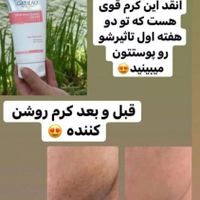 مشاور پوست و مو روتین پوستی کرم های ضدجوش لک چروک|آرایشی، بهداشتی، درمانی|تهران, باغ فیض|دیوار