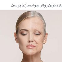 آموزش تخصصی میکرونیدلینگ و مزونیدلینگ|خدمات آرایشگری و زیبایی|تهران, پاسداران|دیوار