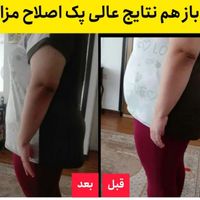 دمنوش کوه چربی سوز|خوردنی و آشامیدنی|تهران, اختیاریه|دیوار