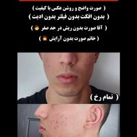 پکیج ورزشی vipزاویه صورت|آرایشی، بهداشتی، درمانی|تهران, جنت‌آباد جنوبی|دیوار