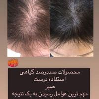 سرم سیر سیاه(تبریز)ارسال نیم ساعته|آرایشی، بهداشتی، درمانی|تبریز, |دیوار