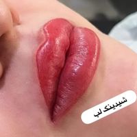 خدمات میکروبلیدینگ و ریموو تخصصی|خدمات آرایشگری و زیبایی|تهران, زمزم|دیوار