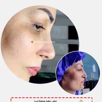 جشنواره جراحی و عمل بینی/لیفت/پلک|خدمات آرایشگری و زیبایی|کرج, درختی|دیوار