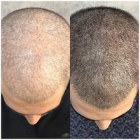 موهاتو پرپشت کن در سه ساعت|خدمات آرایشگری و زیبایی|تهران, صادقیه|دیوار