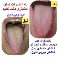 با زبان شناسی ازبیماری های داخلی بدن خودآگاه شوید|خدمات آرایشگری و زیبایی|تهران, تجریش|دیوار