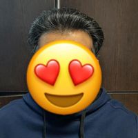 کاشت مو و ابرو به روش شیراز در اصفهان(اقساطی)|خدمات آرایشگری و زیبایی|اصفهان, مرداویج|دیوار