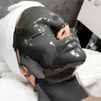 پاکسازی تخصصی پوست|خدمات آرایشگری و زیبایی|تهران, فدک|دیوار