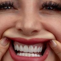 کامپوزیت دندان،لمینیت،روکش،عصب کشی|خدمات آرایشگری و زیبایی|تهران, شهرک غرب|دیوار