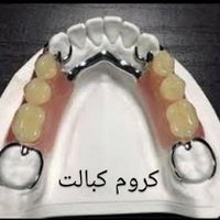 ساخت دندان مصنوعی هر فک فقط دو میلیون|خدمات آرایشگری و زیبایی|تهران, شمشیری|دیوار