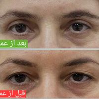 بلفارو پلاستی حرفه ای|خدمات آرایشگری و زیبایی|تهران, بلوار کشاورز|دیوار