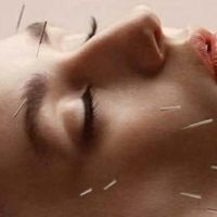 برگزاری همایش طب سوزنی صفر تا صد|گردهمایی و همایش|تهران, خاوران|دیوار